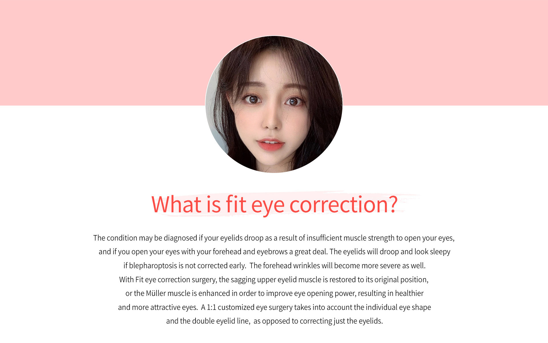 FIT 눈매교정