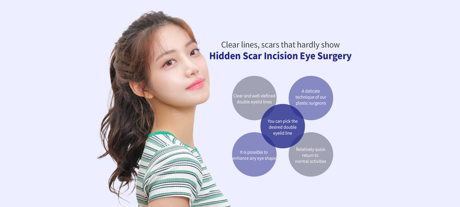 히든스카절개눈성형